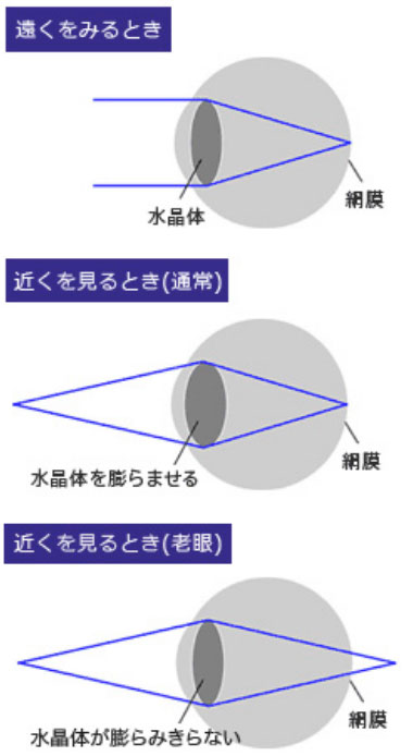 老眼（老視）とは